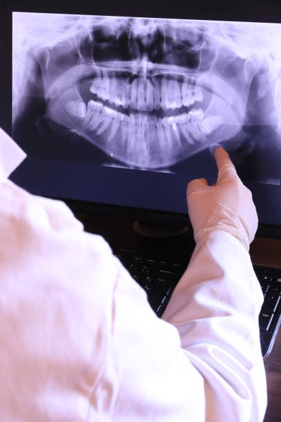 Best Emergency Treatment for Dental Infections or Abscesses in Safford, AZ